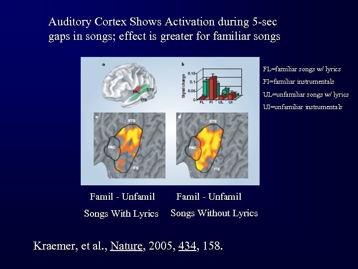 Auditory Cortex Shows Activation during 5 -sec gaps in songs; effect is greater for