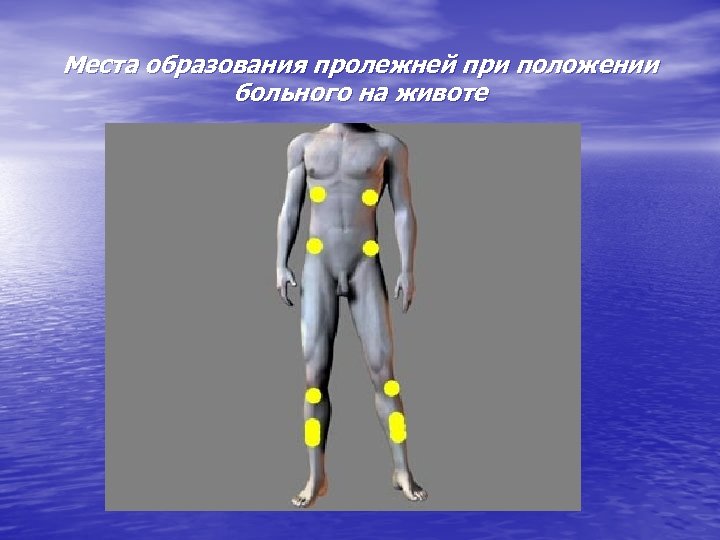 Места образования пролежней при положении больного на животе 