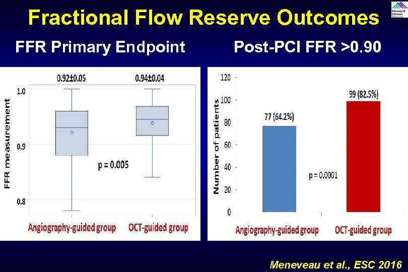 Fractional Flow Reserve Outcomes FFR Primary Endpoint Post-PCI FFR >0. 90 Meneveau et al.