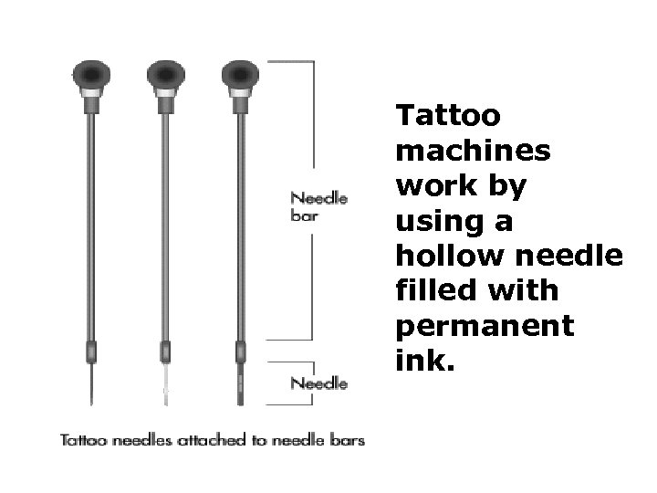 Tattoo machines work by using a hollow needle filled with permanent ink. 
