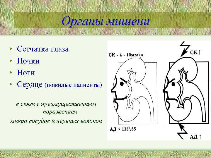 Органы мишени • • Сетчатка глаза Почки Ноги Сердце (пожилые пациенты) в связи с