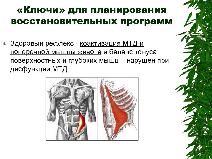  «Ключи» для планирования восстановительных программ Здоровый рефлекс - коактивация МТД и поперечной мышцы