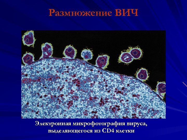 Размножение ВИЧ Электронная микрофотография вируса, выделяющегося из CD 4 клетки 