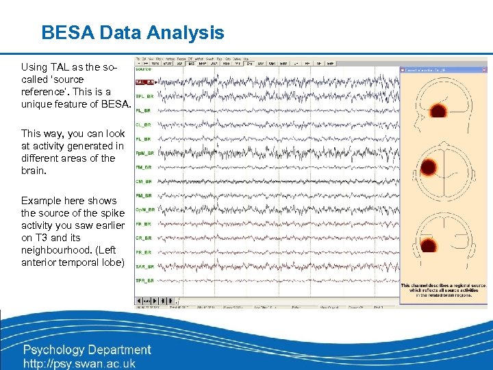 BESA Data Analysis Using TAL as the socalled ‘source reference’. This is a unique