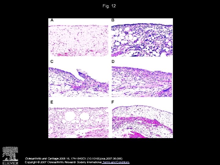 Fig. 12 Osteoarthritis and Cartilage 2008 16, 174 -184 DOI: (10. 1016/j. joca. 2007.