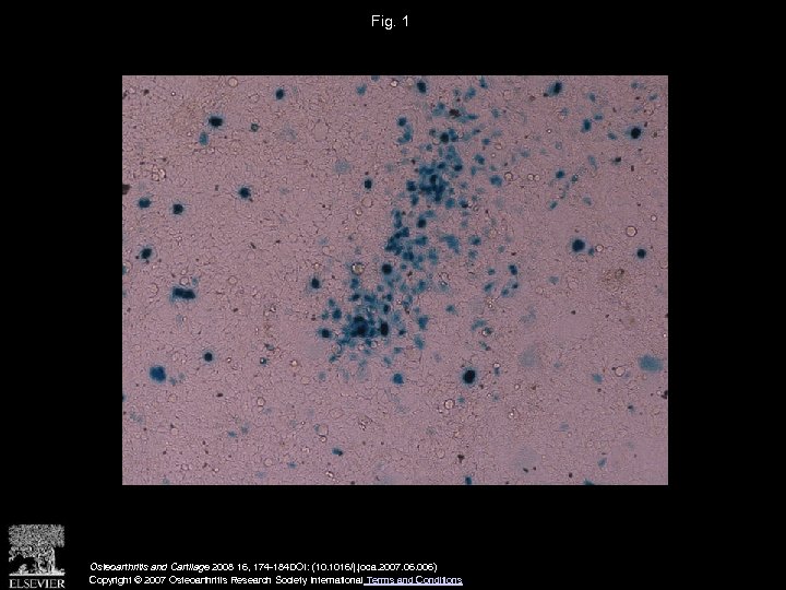 Fig. 1 Osteoarthritis and Cartilage 2008 16, 174 -184 DOI: (10. 1016/j. joca. 2007.