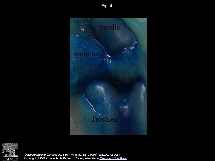 Fig. 4 Osteoarthritis and Cartilage 2008 16, 174 -184 DOI: (10. 1016/j. joca. 2007.