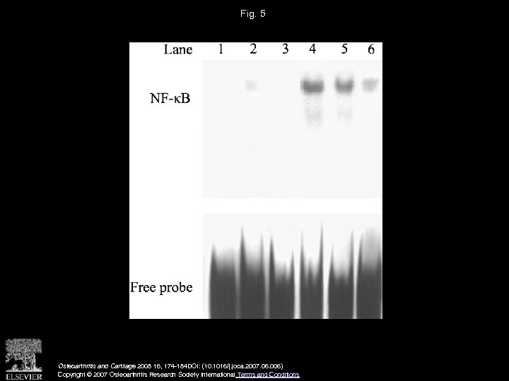 Fig. 5 Osteoarthritis and Cartilage 2008 16, 174 -184 DOI: (10. 1016/j. joca. 2007.