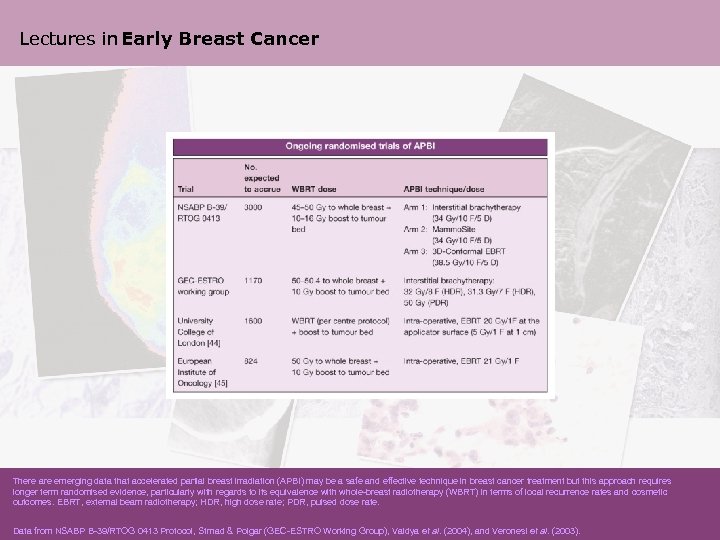 Lectures in Early Breast Cancer There are emerging data that accelerated partial breast irradiation