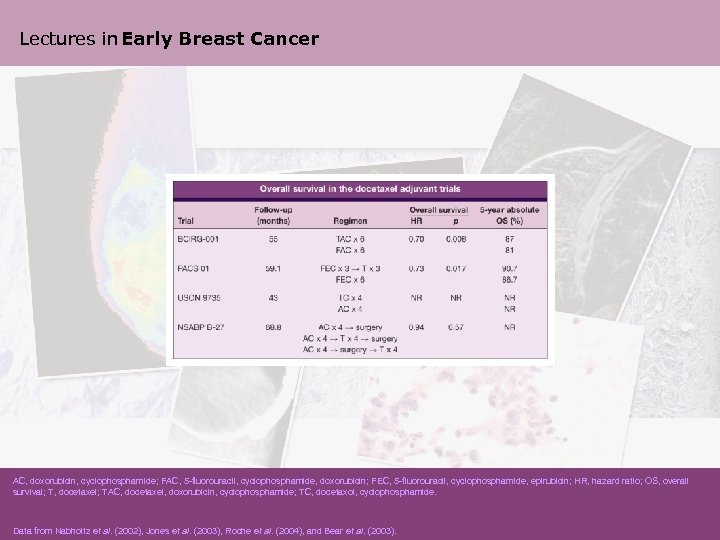 Lectures in Early Breast Cancer AC, doxorubicin, cyclophosphamide; FAC, 5 -fluorouracil, cyclophosphamide, doxorubicin; FEC,