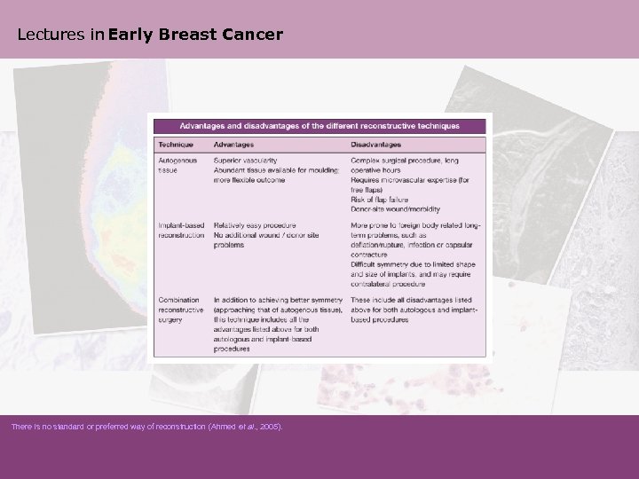 Lectures in Early Breast Cancer There is no standard or preferred way of reconstruction
