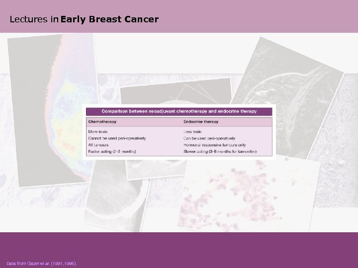 Lectures in Early Breast Cancer Data from Gazet et al. (1991, 1996). 
