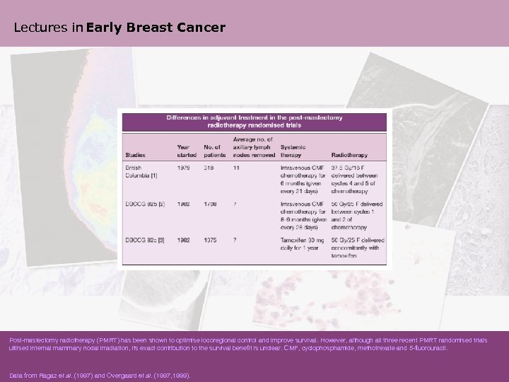 Lectures in Early Breast Cancer Post-mastectomy radiotherapy (PMRT) has been shown to optimise locoregional