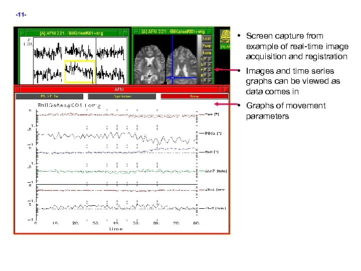 -11 - • Screen capture from example of real-time image acquisition and registration •