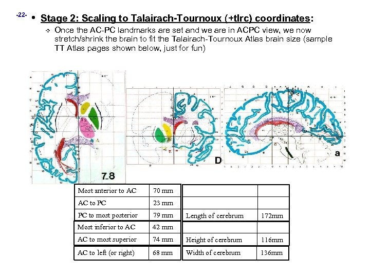 -22 - • Stage 2: Scaling to Talairach-Tournoux (+tlrc) coordinates: Once the AC-PC landmarks