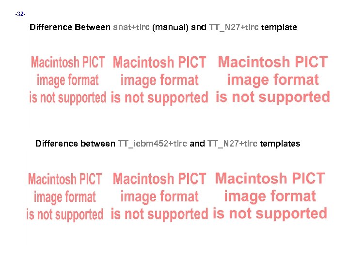 -32 - Difference Between anat+tlrc (manual) and TT_N 27+tlrc template Difference between TT_icbm 452+tlrc