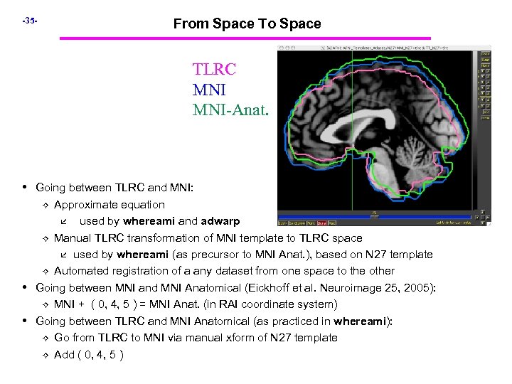 -35 - From Space To Space TLRC MNI-Anat. • Going between TLRC and MNI: