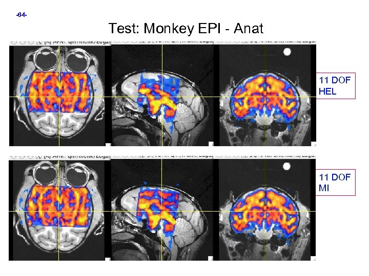-64 - Test: Monkey EPI - Anat 11 DOF HEL 11 DOF MI 