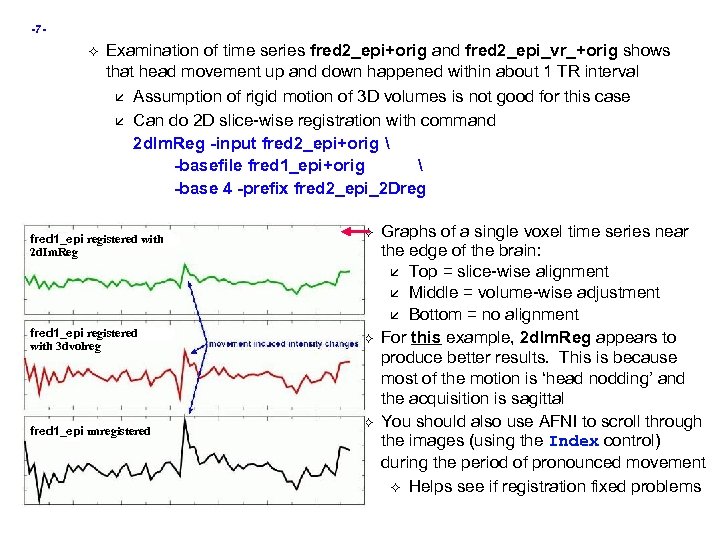 -7 - Examination of time series fred 2_epi+orig and fred 2_epi_vr_+orig shows that head