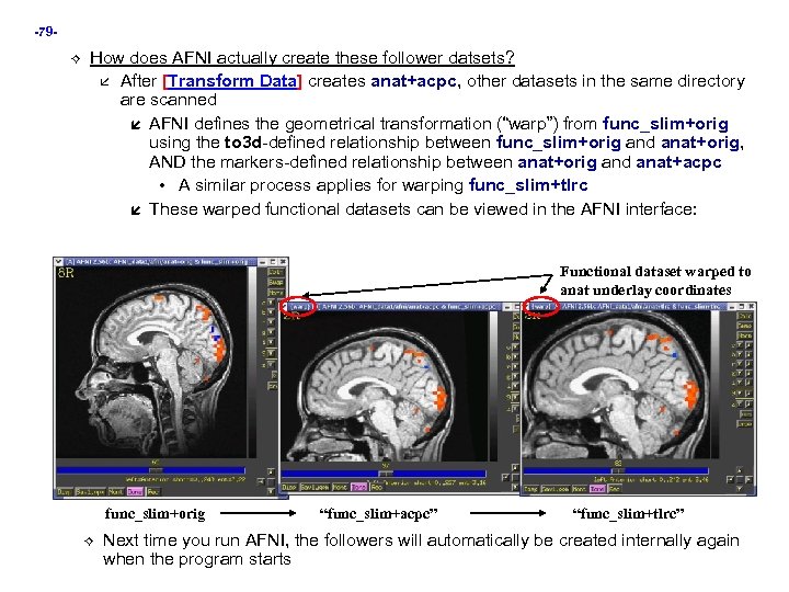 -79 How does AFNI actually create these follower datsets? After [Transform Data] creates anat+acpc,
