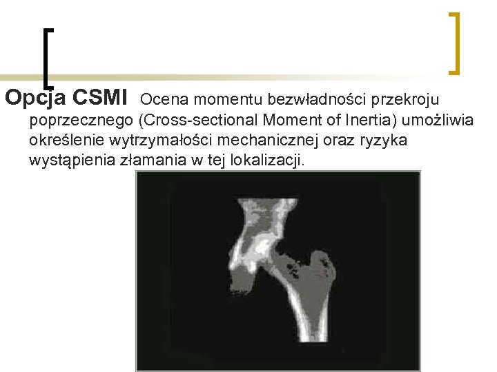 Opcja CSMI Ocena momentu bezwładności przekroju poprzecznego (Cross-sectional Moment of Inertia) umożliwia określenie wytrzymałości