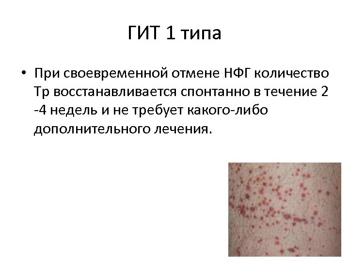 ГИТ 1 типа • При своевременной отмене НФГ количество Тр восстанавливается спонтанно в течение