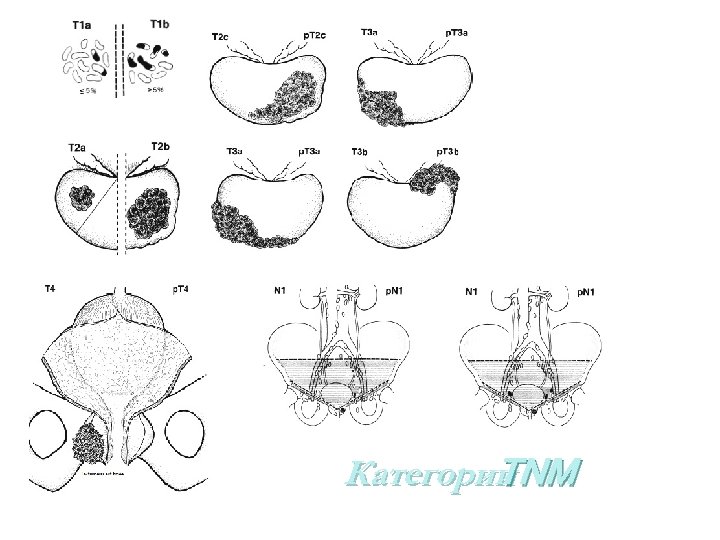 Категории NМ Т 