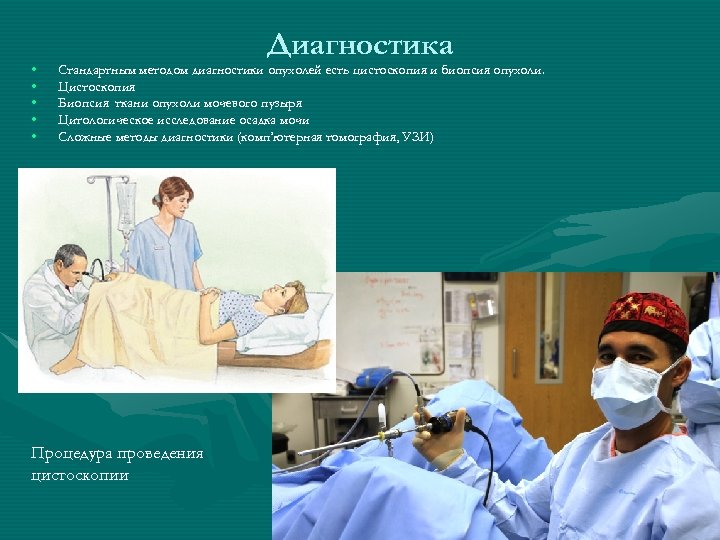  • • • Диагностика Стандартным методом диагностики опухолей есть цистоскопия и биопсия опухоли.