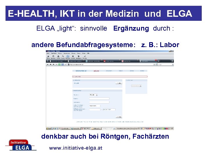 E-HEALTH, IKT in der Medizin und ELGA „light“: sinnvolle Ergänzung durch : andere Befundabfragesysteme: