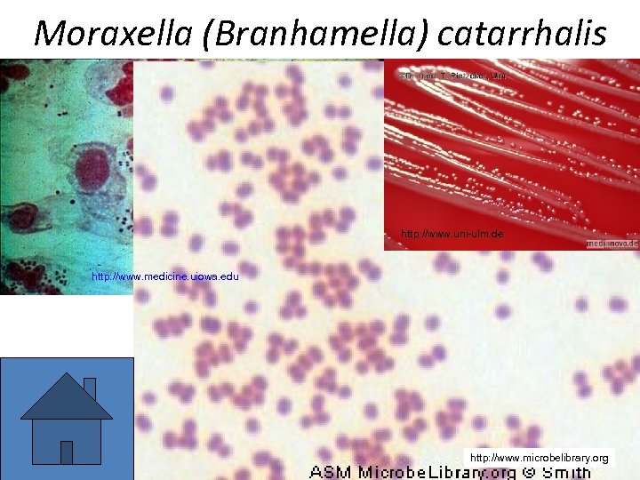 Moraxella (Branhamella) catarrhalis http: //www. uni-ulm. de http: //www. medicine. uiowa. edu http: //www.