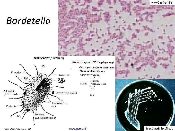 www 2. mf. uni-lj. si Bordetella www. gpo. or. th http: //medinfo. ufl. edu