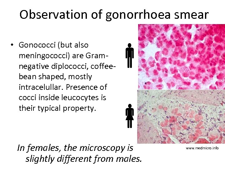 Observation of gonorrhoea smear • Gonococci (but also meningococci) are Gramnegative diplococci, coffeebean shaped,