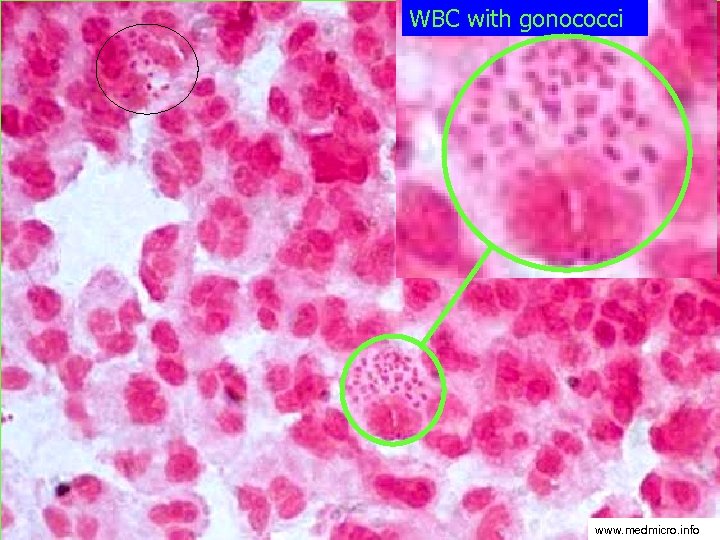 WBC with gonococci www. medmicro. info 