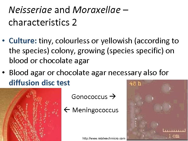 Neisseriae and Moraxellae – characteristics 2 • Culture: tiny, colourless or yellowish (according to