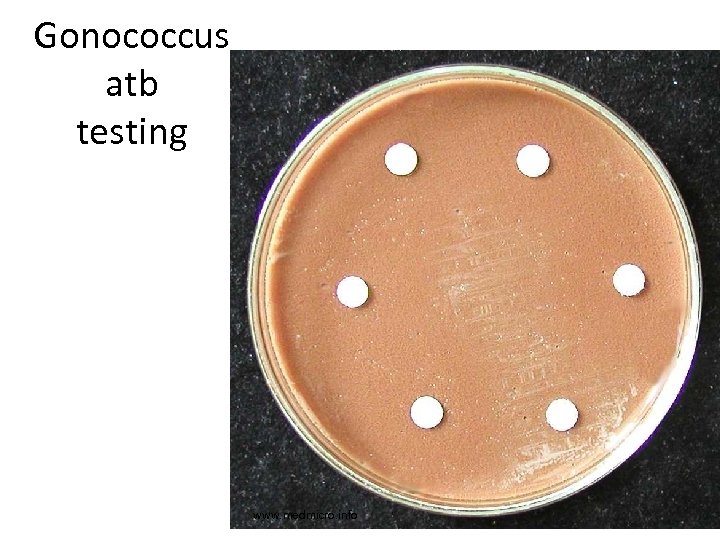 Gonococcus atb testing www. medmicro. info 