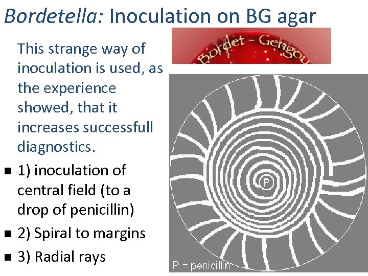 Bordetella: Inoculation on BG agar n n n This strange way of inoculation is