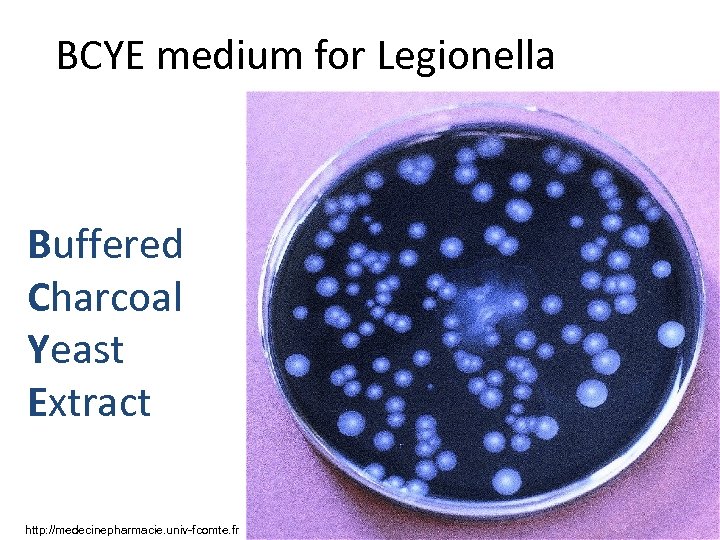 BCYE medium for Legionella Buffered Charcoal Yeast Extract http: //medecinepharmacie. univ-fcomte. fr 