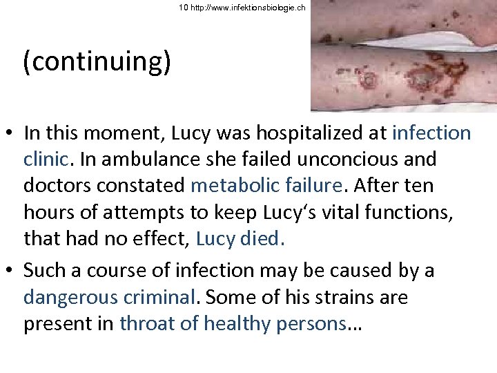 10 http: //www. infektionsbiologie. ch (continuing) • In this moment, Lucy was hospitalized at