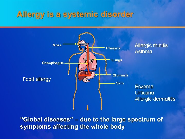 Allergy is a systemic disorder Nose Oesophagus Food allergy Pharynx Allergic rhinitis Asthma Lungs