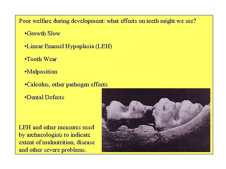 Poor welfare during development: what effects on teeth might we see? • Growth Slow
