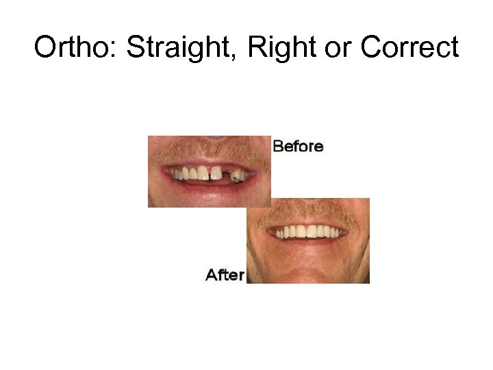 Ortho: Straight, Right or Correct 