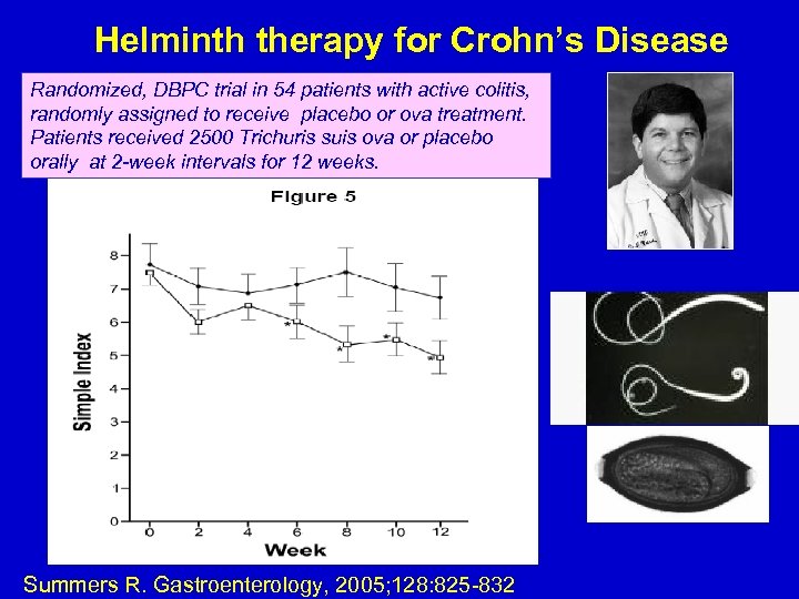 Helminth therapy for Crohn’s Disease Randomized, DBPC trial in 54 patients with active colitis,