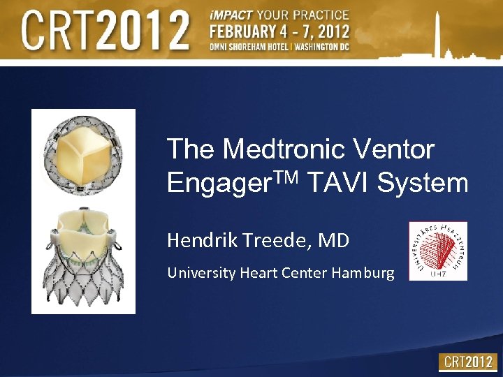 The Medtronic Ventor Engager. TM TAVI System Hendrik Treede, MD University Heart Center Hamburg