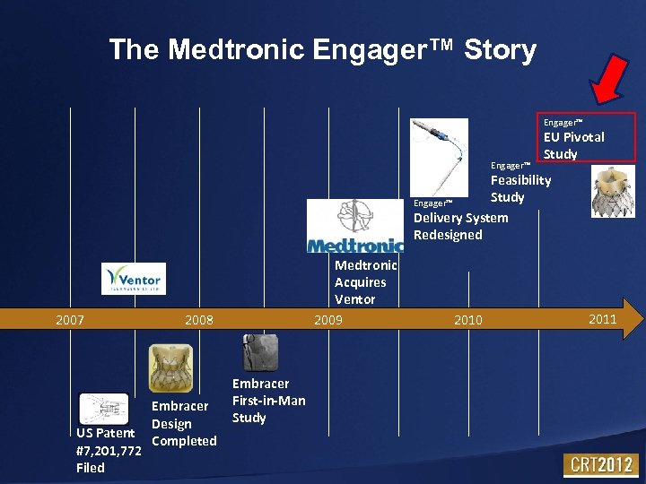 The Medtronic Engager™ Story Engager™ EU Pivotal Study Feasibility Study Engager™ Delivery System Redesigned