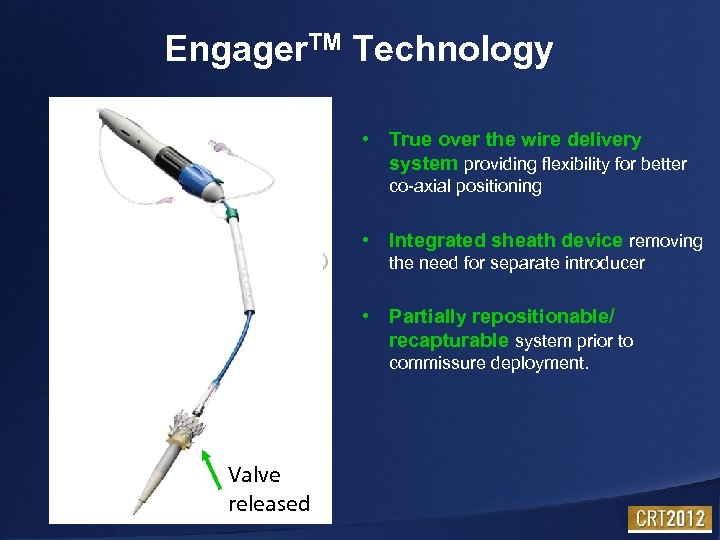 Engager. TM Technology • True over the wire delivery system providing flexibility for better