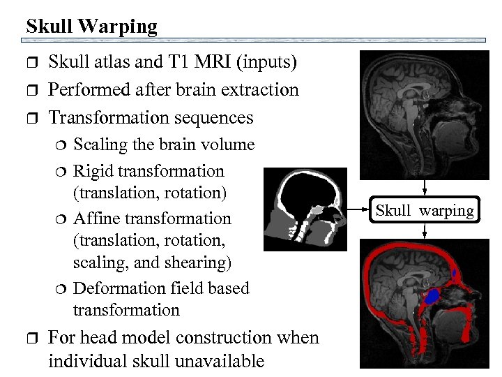 Skull Warping r r r Skull atlas and T 1 MRI (inputs) Performed after