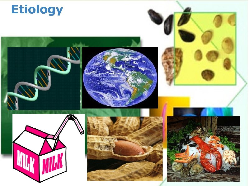 Etiology 