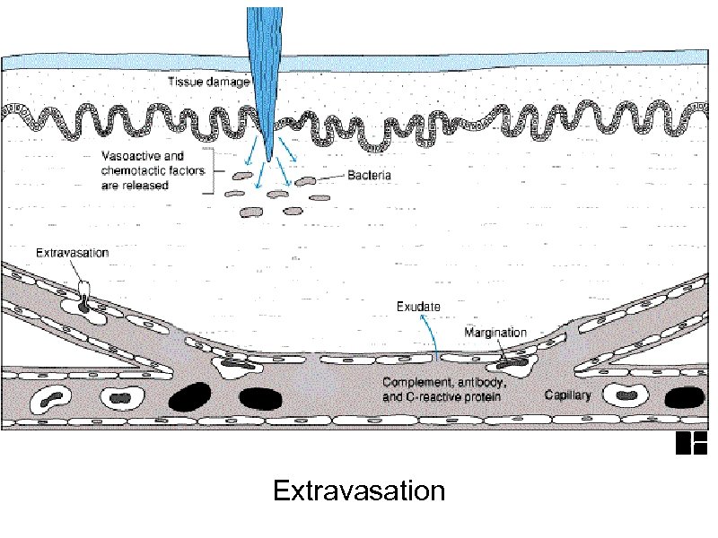 Extravasation 