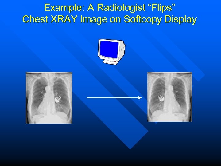 Example: A Radiologist “Flips” Chest XRAY Image on Softcopy Display 