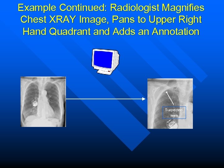 Example Continued: Radiologist Magnifies Chest XRAY Image, Pans to Upper Right Hand Quadrant and